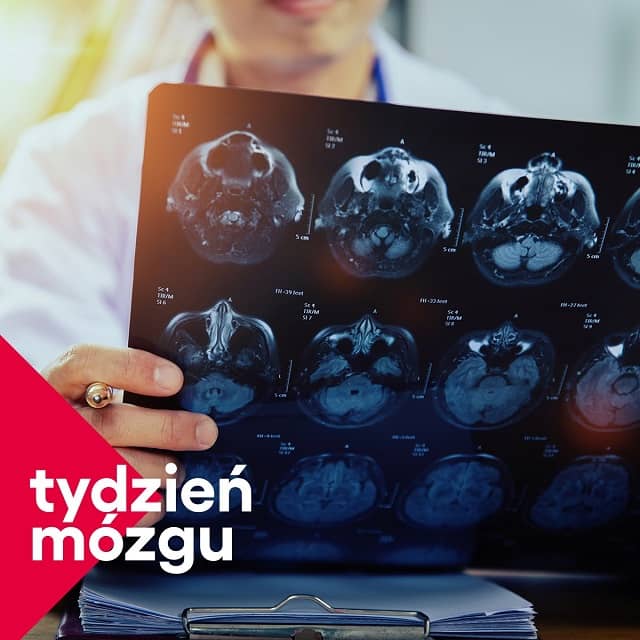 Grafika poglądowa do tekstu